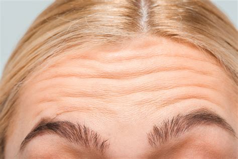 Wrinkles and Fine Lines - EZRA Clinic