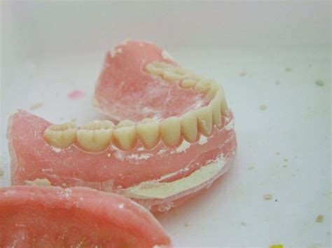 5 Things to Know About Temporary Dentures - Vranjes Denture Clinic