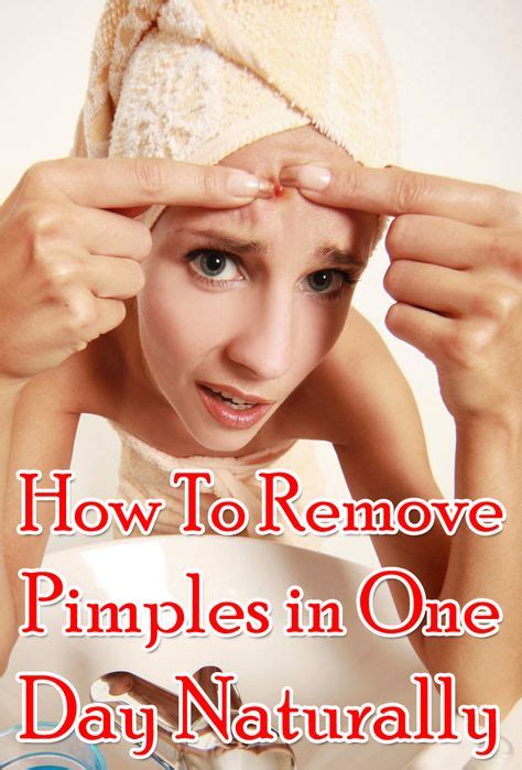 8 Best Pimple solution images | How to get rid of acne, Acne treatment ...