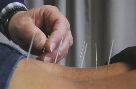 ACUPUNCTURE.MD – Акупунктура в Молдове. Иглоукалывание. Рефлексотерапия ...