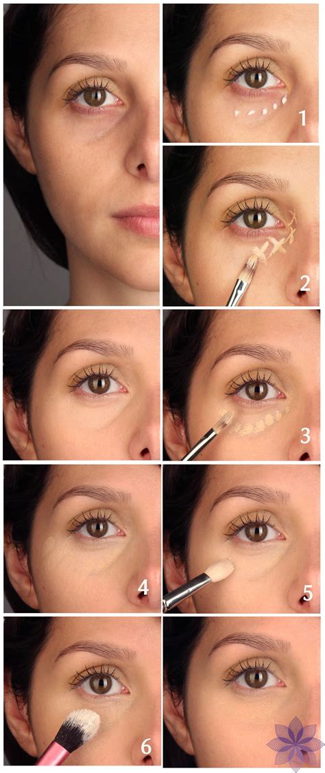 Hemorrhoid Treatment Under Their Eyes at Laura Granados blog