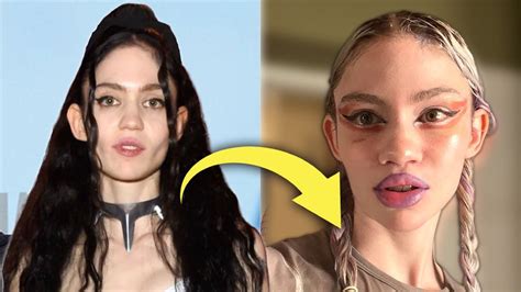 Grimes Admits to Plastic Surgery: the Start of the Era of Plastic ...