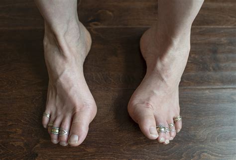 Inversion Of Foot
