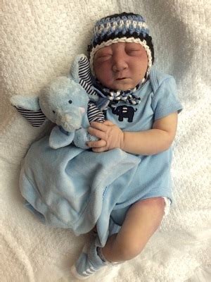 Shane Michael, the story of a baby with anencephaly