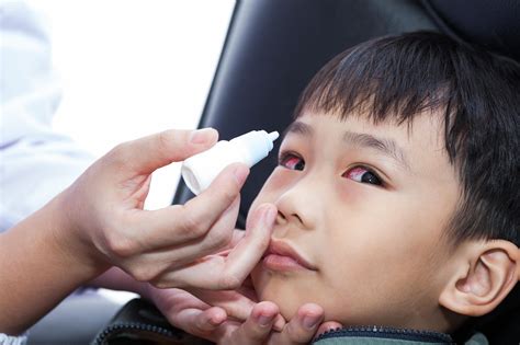 Viral Conjunctivitis Pediatric