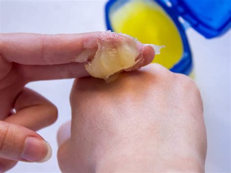 What is petroleum jelly? | Poison Control