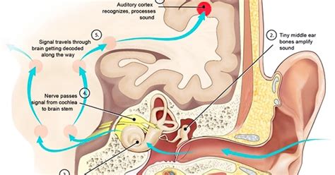 Hello USA: otitis interna symptoms