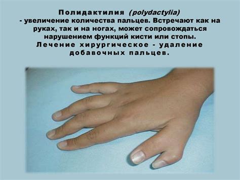 Врожденные пороки развития - презентация онлайн