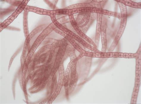 red algae microscope