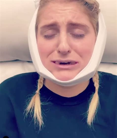 Can I Zyn After Wisdom Teeth Social Post Detail