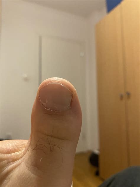 Hair grows on my toe. : r/notinteresting