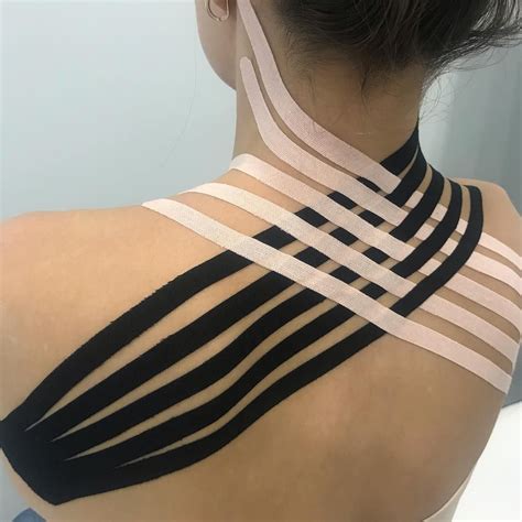 Тейпирование шеи | Kinesiology taping, Kinesio taping, Body massage