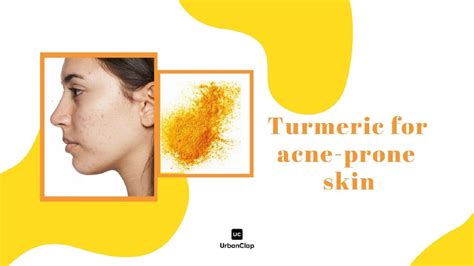 Turmeric for Acne | 5 DIY Face Masks for Acne – The Urban Guide