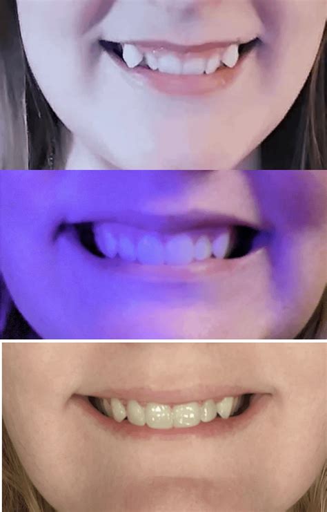 Rosealine Dawnxs: Her Before & After Results Are Truly Inspiring! Image 20