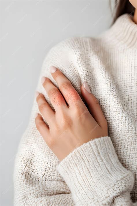 Woman with skin diseases Red spot or rash of skin on womans hand Itchy