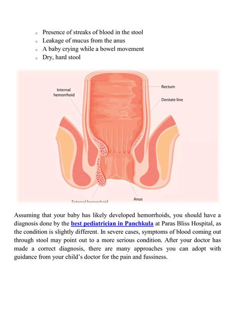 Hemorrhoids in babies symptoms and causes | PDF