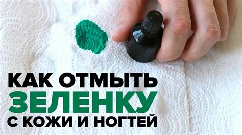Как и чем оттереть зеленку с кожи рук и ногтей - YouTube