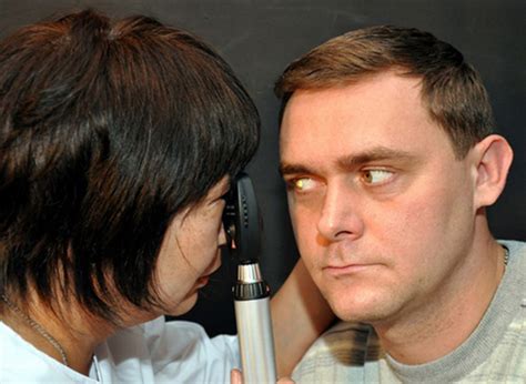 Косоглазие: это что, как называется и можно определить угол по ...