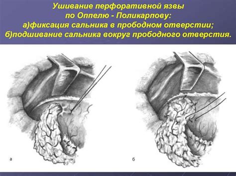 Хирургическая операция. Первичная хирургическая обработка раны - online ...