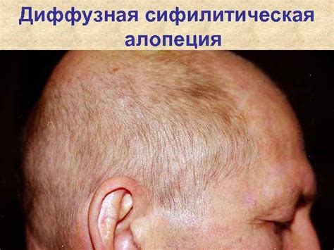 Самарский Государственный Медицинский Университет