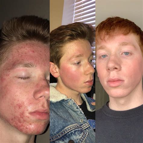 This Is What Happened Before, During, And After The Imacribaby Leak Image 8