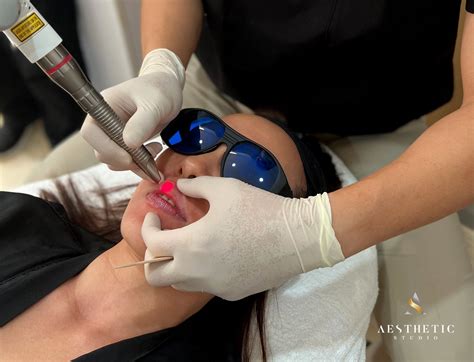 fotona liplase  aesthetic studio singapore clinic surgery