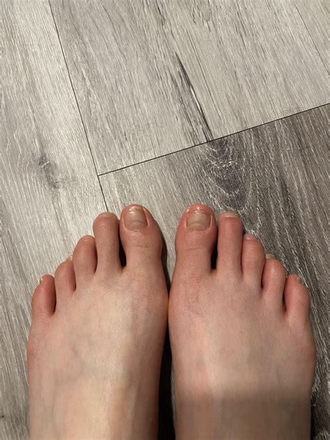 Could this be chilblains? My toes have been intensely itchy and red all