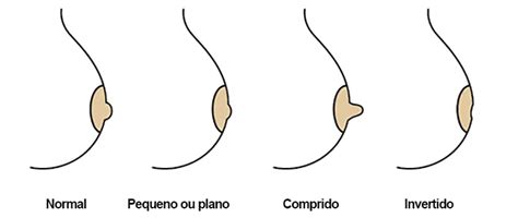 Mamilos Protusos
