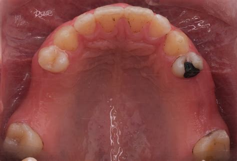 Case Gallery - ClearCorrect