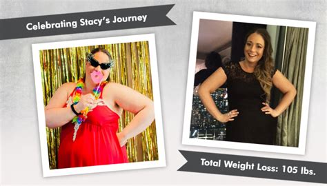 Before & After RNY with Stacy : ObesityHelp