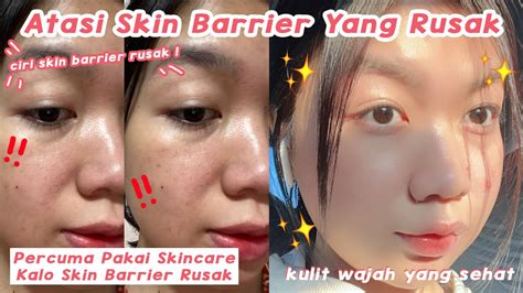 mengatasi skin barrier  rusak desty yufenti youtube