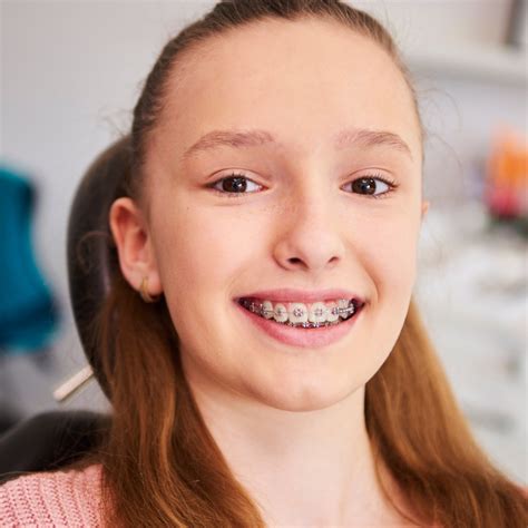 Braces for Kids in The Woodlands | Auburn Lakes Orthodontics