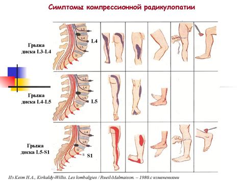 Боли в спине. Актуальность проблемы - презентация онлайн