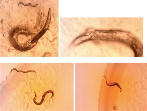 figure   isolating  characterizing   sp  dauer larva
