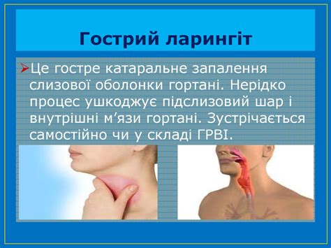 Захворювання органів дихання. Риніт, отит, фарингіт, трахеїт, ларингит ...