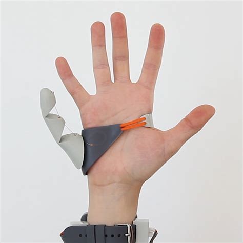 While most prosthetics "fix" or "replace," this designer created a ...