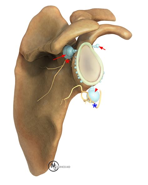 Shoulder Cysts | Radsource