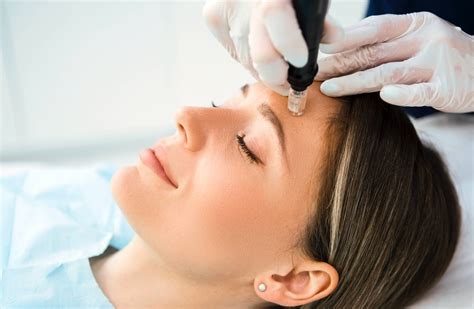 Contact Us | Perfect Laser Clinics