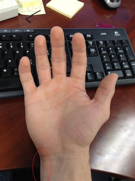 Wrist hurting when I rotate it : r/Fitness