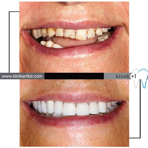 Klinik +1 Özel Diş Kliniği - Sağlıklı Dişler Güzel Gülüşler
