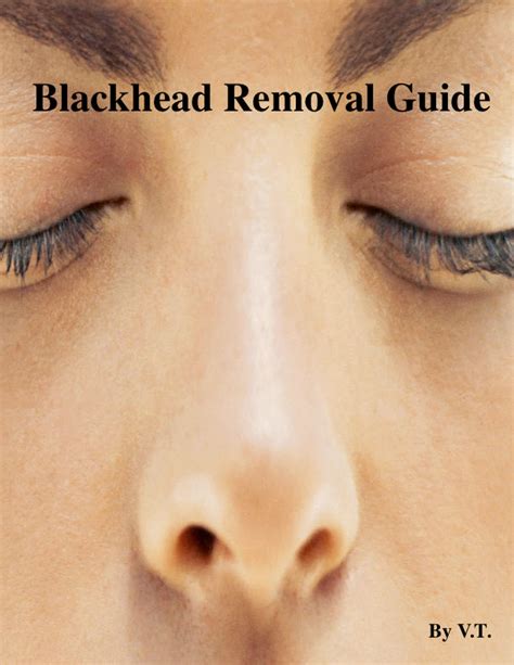 The Dermatologist's Guide To Unbelievable Blackhead Removal 2024. Image 1