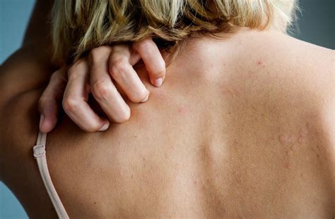 What Are The Causes Of Ear Pressure? 12 Common Triggers - OptingHealth