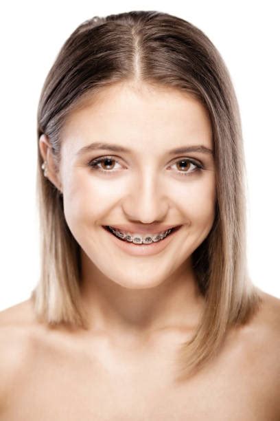 400+ Gold Braces Stock Photos, Pictures & Royalty-Free Images - iStock