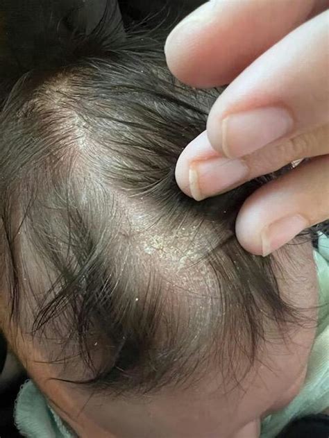 Coconut Oil Baby Hair Products for Dry Scalp and Dry Skin | Bubbsi