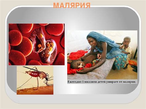 Малярия: причины, распространение, симптомы и лечение