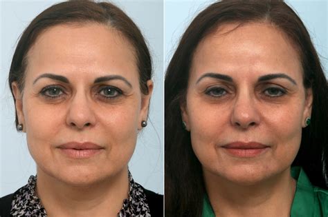 6 Ways To Achieve A Beautiful Jawline, Minus the Surgery | Houston, TX