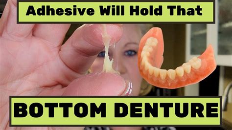 Best Dental Adhesive For Lower Dentures at maxspeebleso blog