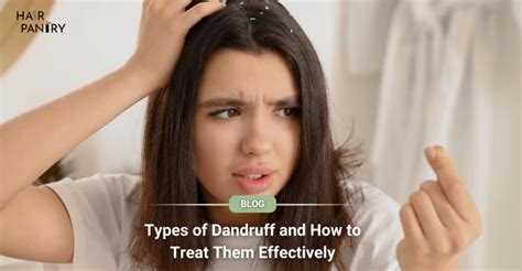 Types of Dandruff and How to Treat Them Effectively - The Hair Pantry