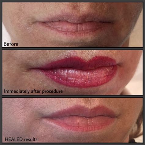 Permanent Makeup Lips Before and After - Hair Illusions