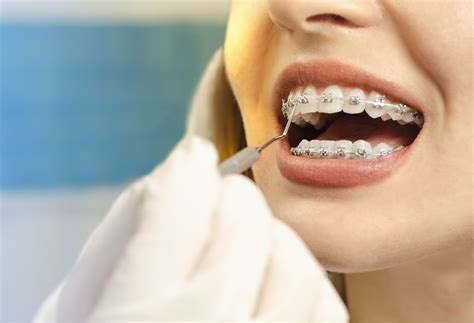 Adult Straight Teeth On The Tops Are Not My
